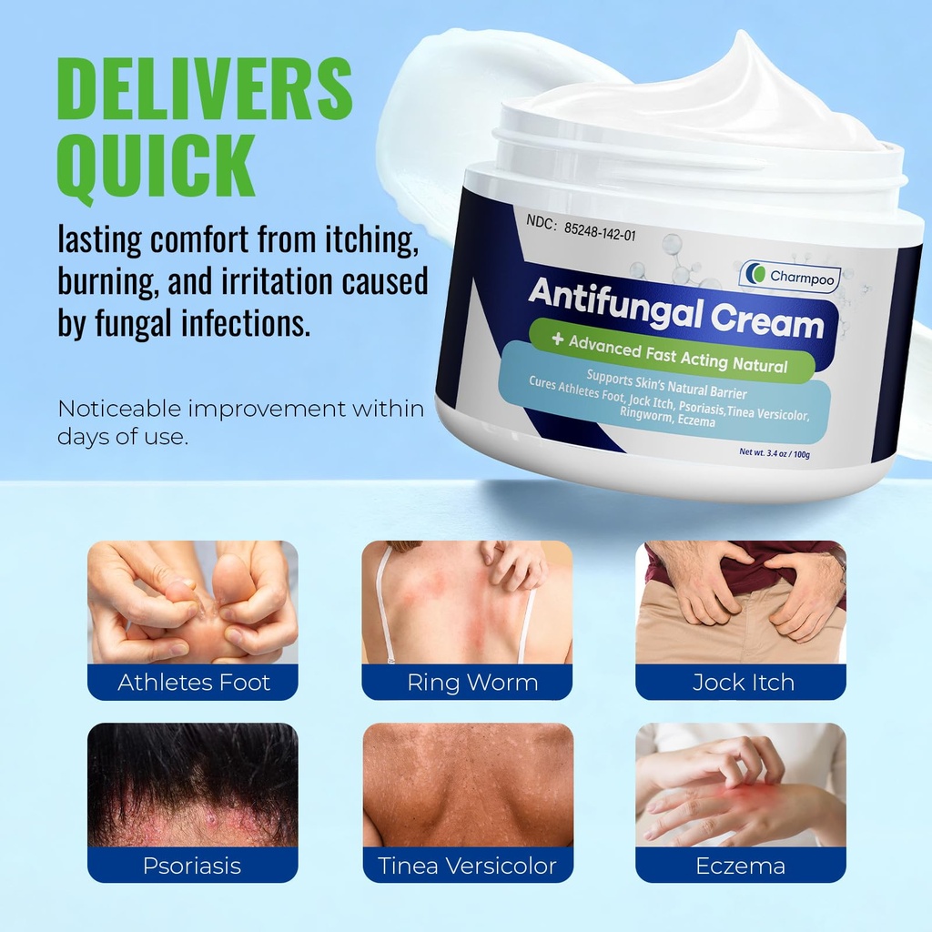 charmpoo-antifungal-cream-2-miconazole-f-2.jpg