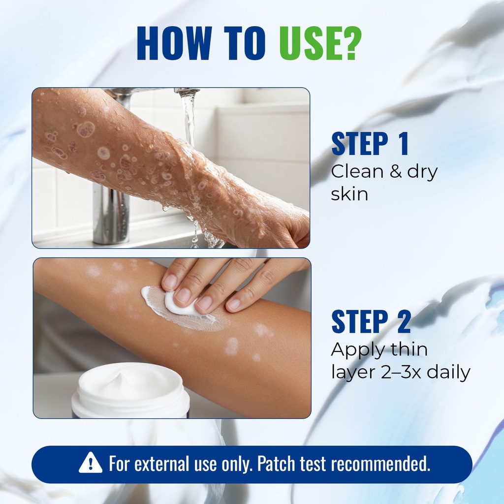 charmpoo-antifungal-cream-2-miconazole-f-4.jpg