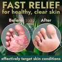 terramed-just-think-comfort-foot-spray-w-5.jpg