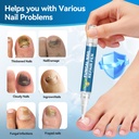 nail-fungus-pen-maximum-strength-toenail-6.jpg