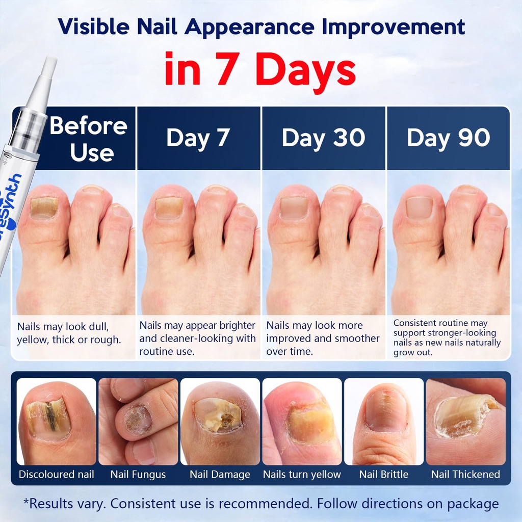 extra-strength-nail-fungus-repair-pen-ot-2.jpg