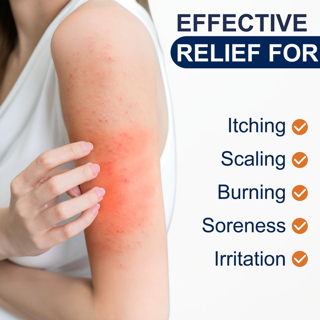 antifungal-cream-for-jock-itch-athletes--4.jpg