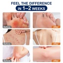 antifungal-cream-for-jock-itch-athletes--3.jpg