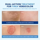 hermon-tinea-versicolor-treatment-cream--3.jpg