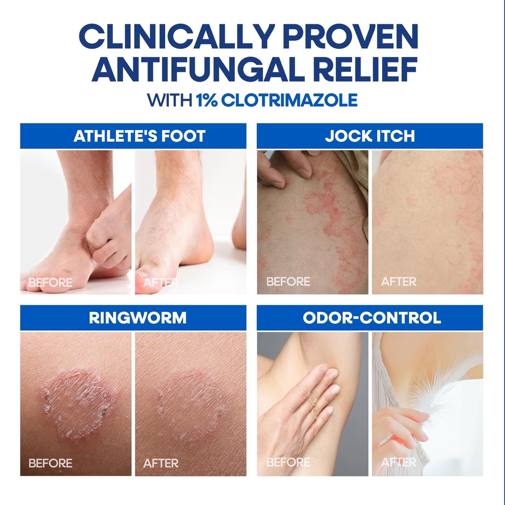 hermon-clotrimazole-antifungal-treatment-6.jpg
