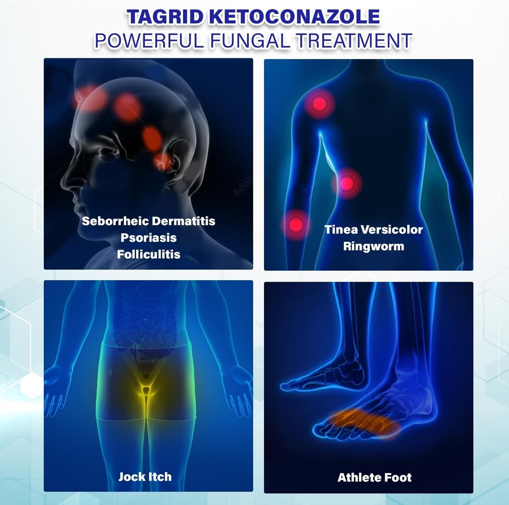 tagrid-antifungal-cream-for-ringworm-tin-6.jpg