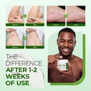 inlifay-2-miconazole-antifungal-cream-he-6.jpg