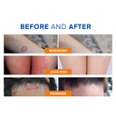 antifungal-ringworm-treatment-body-wash--3.jpg