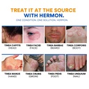 antifungal-ringworm-treatment-body-wash--2.jpg