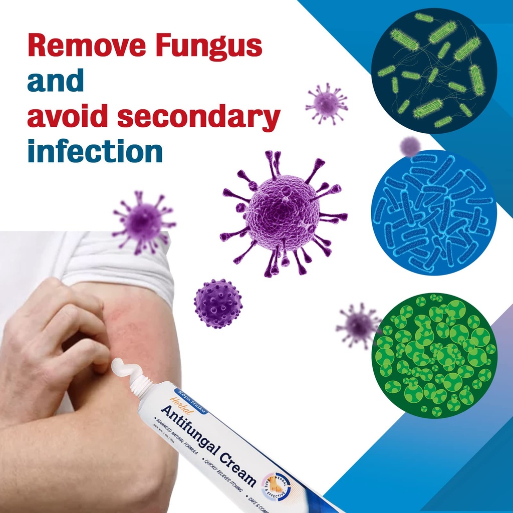 kopa-haiku-antifungal-cream-treatment-fo-5.jpg