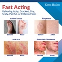 kopa-haiku-antifungal-cream-treatment-fo-3.jpg