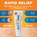 phytozine-anti-fungal-cream-for-skin-wit-3.jpg