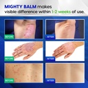 tobcharm-antifungal-cream-with-tea-tree--4.jpg