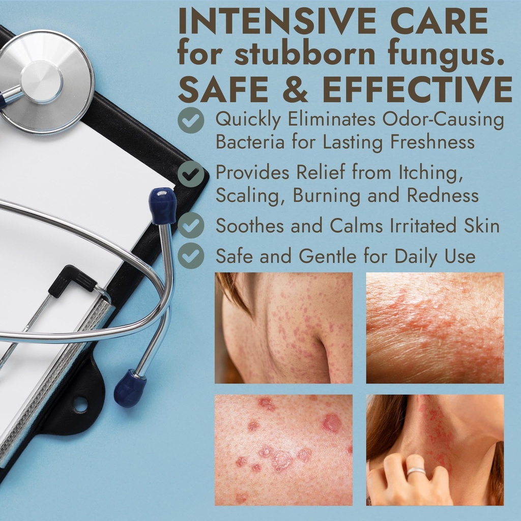 ringworm-cream-ringworm-treatment-for-hu-4.jpg