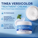 hermon-tinea-versicolor-treatment-cream--2.jpg