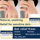 manuka-honey-tea-tree-eczema-psoriasis-c-3.jpg