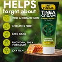 tinea-versicolor-treatment-antifungal-cr-2.jpg