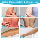 ishancare-antifungal-cream-all-natural-h-5.jpg