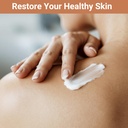 urticaria-cream-for-hives-relief-fast-ac-3.jpg