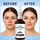 iodine-nasal-spray-2pcs-nasal-iodine-spr-6.jpg