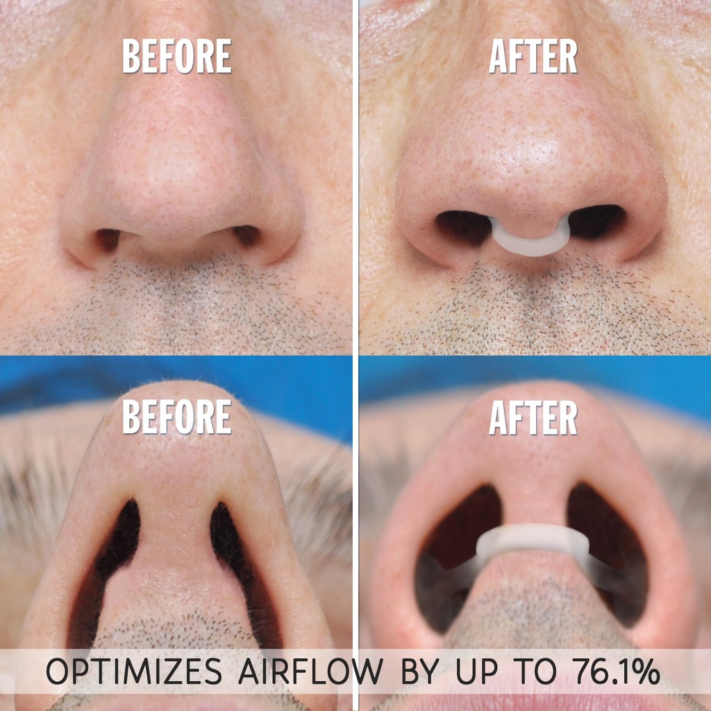 airmax-nasal-dilator-for-better-sleep-na-4.jpg