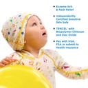 eczema-cradle-cap-rash-itch-relief-for-m-3.jpg