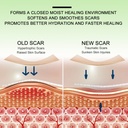silicone-scar-tape-1-6-x-120-3m-sheets-s-6.jpg