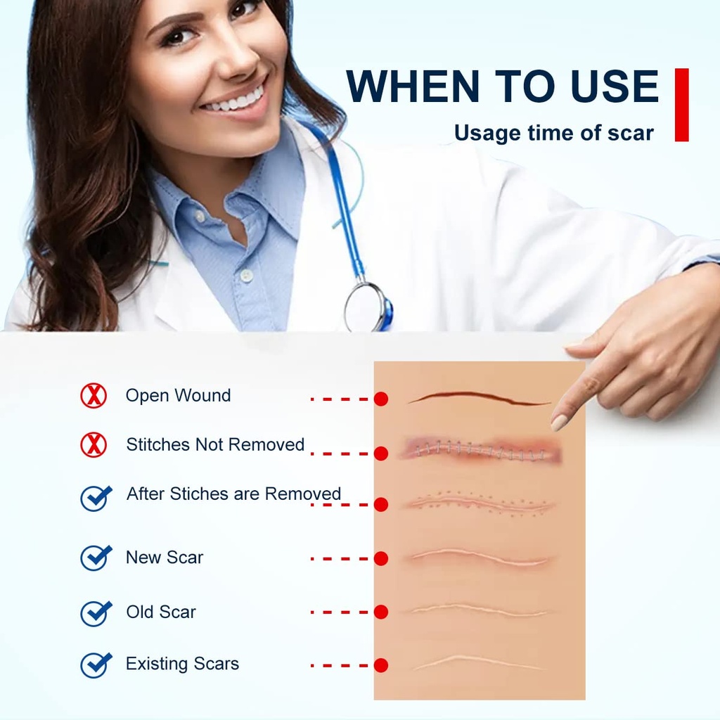 silicone-scar-tape-1-6-x-120-3m-sheets-s-5.jpg