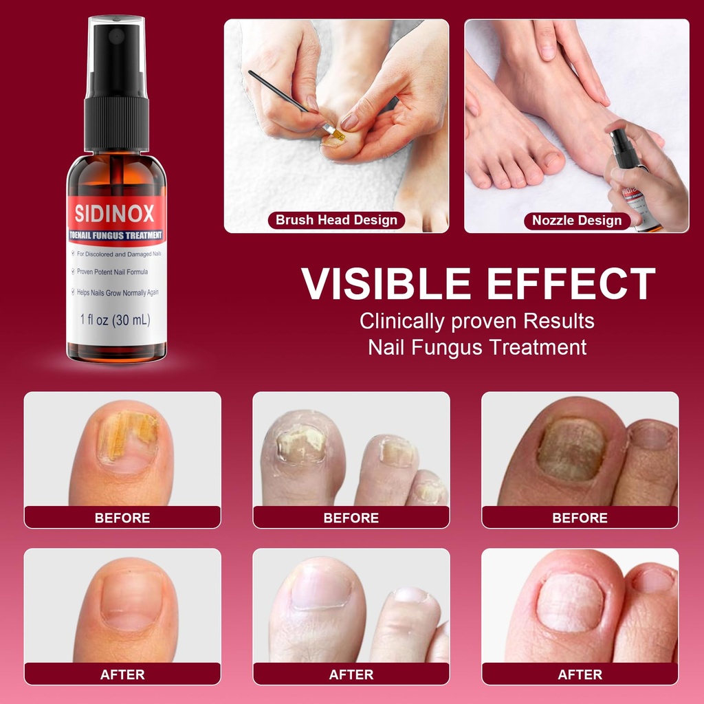 toenail-fungus-treatment-treatment-extra-4.jpg