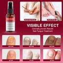 toenail-fungus-treatment-treatment-extra-4.jpg