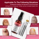 toenail-fungus-treatment-treatment-extra-2.jpg
