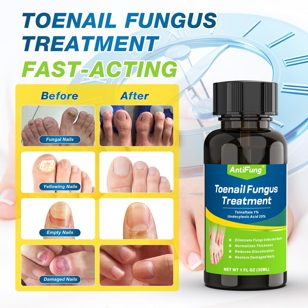 toenail-fungus-treatment-extra-strength--4.jpg