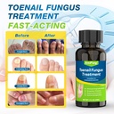 toenail-fungus-treatment-extra-strength--4.jpg