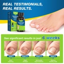 toenail-fungus-treatment-extra-strength--2.jpg
