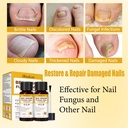 toenail-treatment-extra-strength-with-25-3.jpg