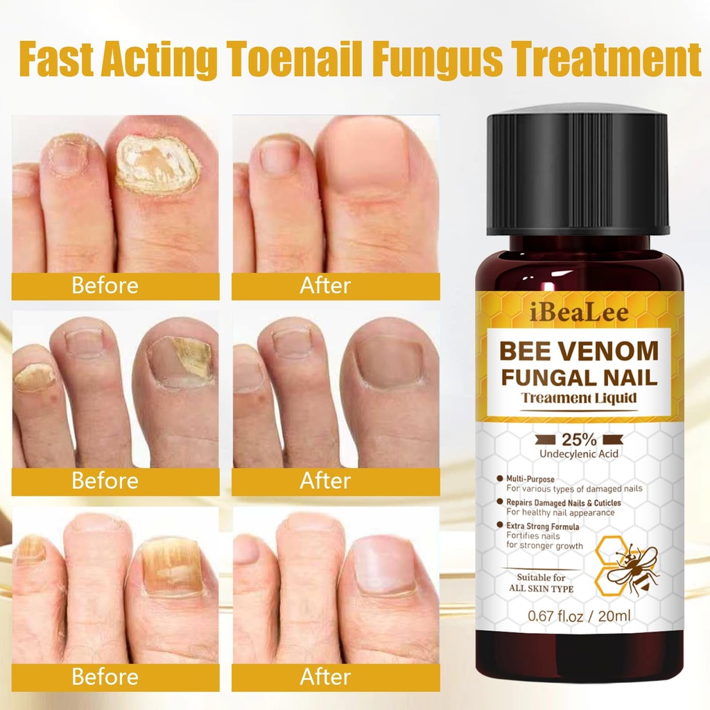 toenail-treatment-extra-strength-with-25-4.jpg