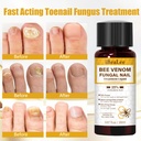 toenail-treatment-extra-strength-with-25-4.jpg