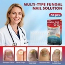 fungal-nail-treatment-swabs-50ct-extra-s-2.jpg