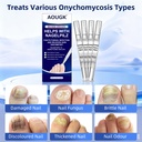toenail-fungus-pen-with-25-undecylenic-a-3.jpg