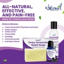 naturasil-tinea-versicolor-treatment-lot-4.jpg