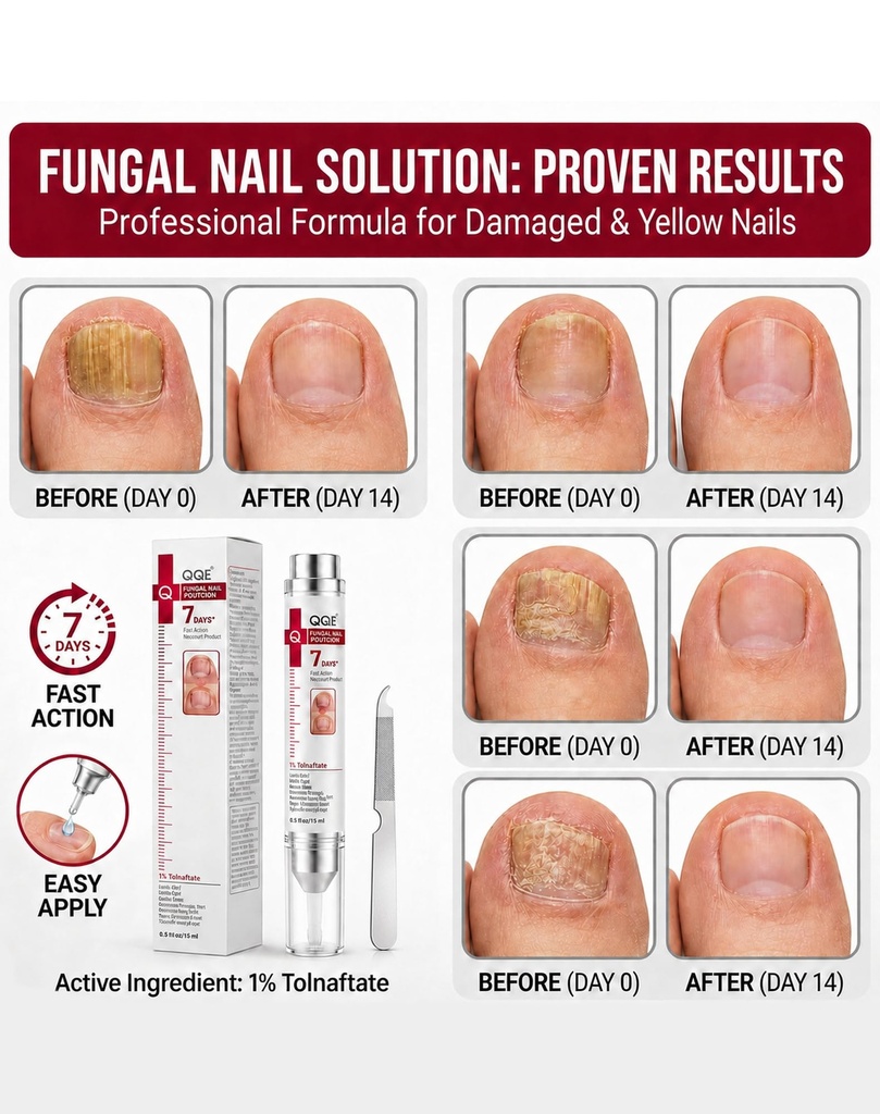 toenail-fungus-treatment-extra-strength--4.jpg
