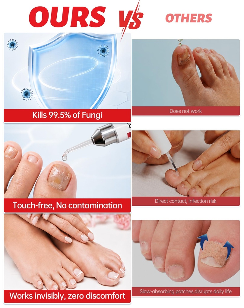 toenail-fungus-treatment-extra-strength--6.jpg