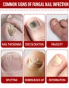 toenail-fungus-treatment-extra-strength--2.jpg