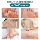 antifungal-cream-for-jock-itch-athlete-s-4.jpg