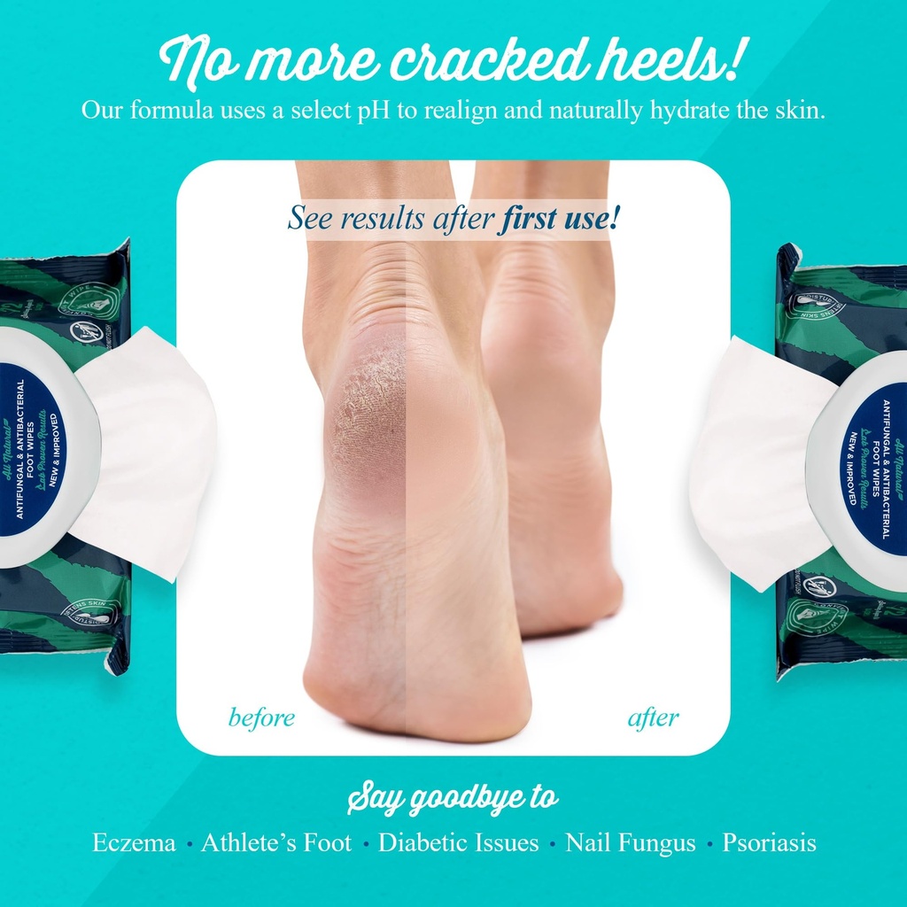 pheet-foot-wipes-all-natural-antifungal--4.jpg