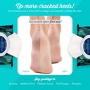 pheet-foot-wipes-all-natural-antifungal--4.jpg
