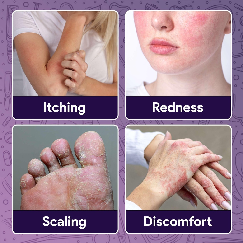 fifthpulse-miconazole-antifungal-cream-1-4.jpg