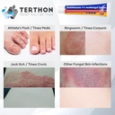 clotrimazole-antifungal-cream-treatment--3.jpg
