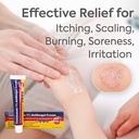clotrimazole-antifungal-cream-treatment--5.jpg