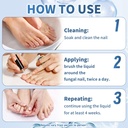 maximum-strength-nail-fungi-treatment-ex-4.jpg